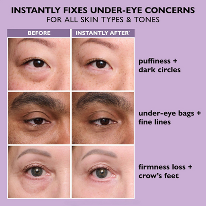 PERFECTION EYE TIGHTENER